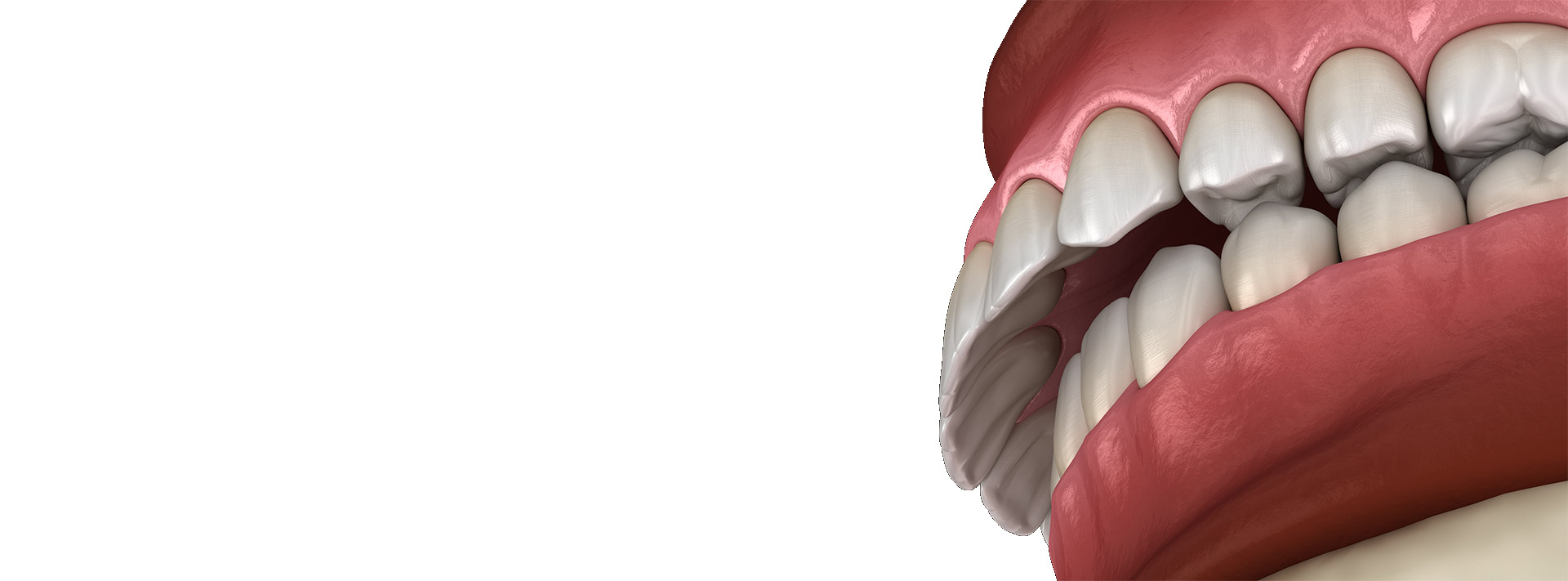 TMJ and Occlusion Course – 18-19 June 2021