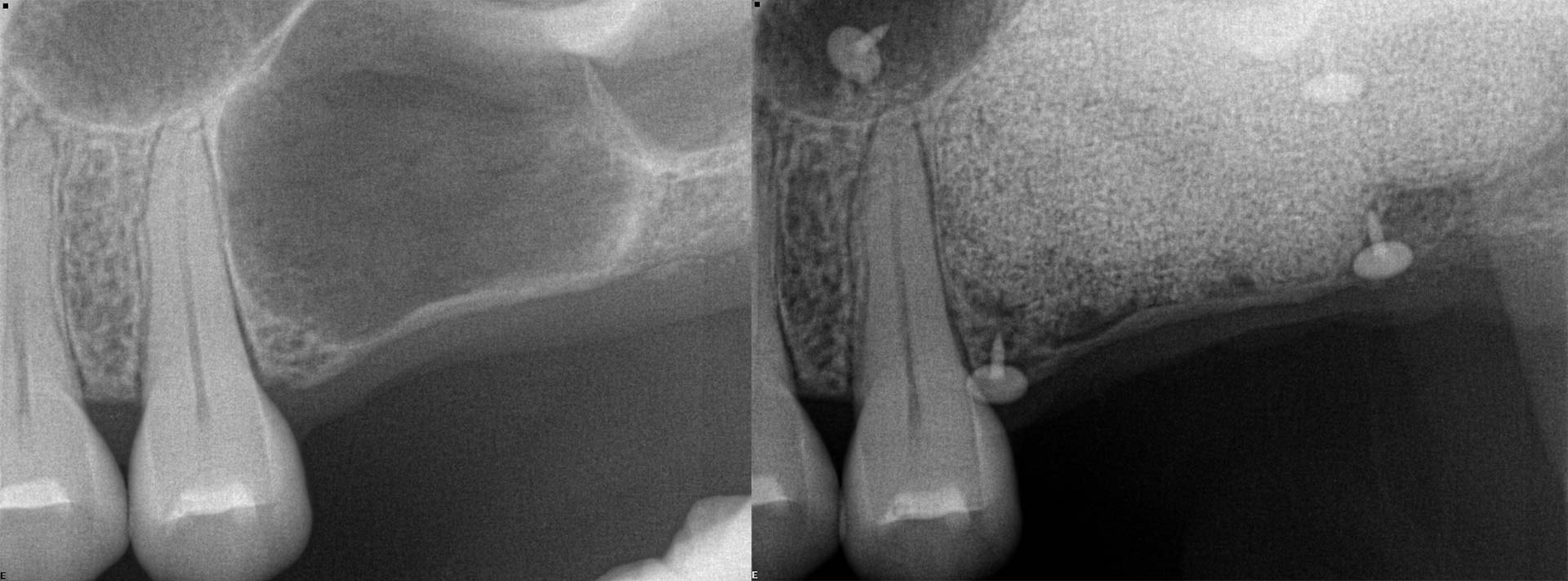 LCIAD Academy Sinus and Bone Augmentation Hands-on Cadaver Course (London, 27 – 29th June 2024)